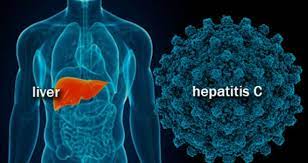 Symptoms of Hepatitis C