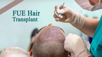 Photo of Some Instructions you should follow after FUE Hair Transplant