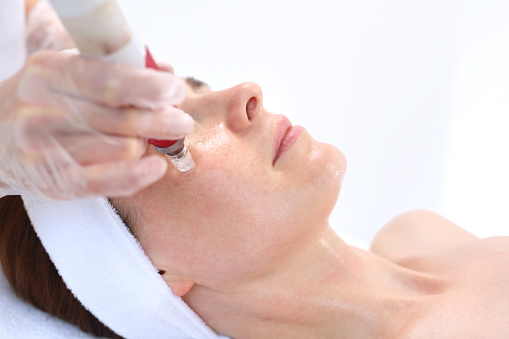 how much does microneedling cost