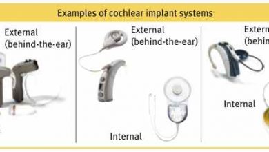 Photo of Cochlear Implant In Child: What Are The Facts And How Does It Work?