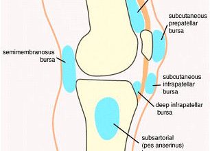 Photo of Runner’s Knee: Mild Chondrosis in The Knee