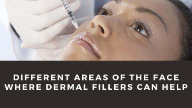 Photo of Different Areas Of The Face Where Dermal Fillers Can Help