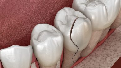 Photo of Can a broken tooth repair itself?