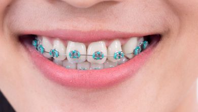 Photo of How to find the best orthodontist near me